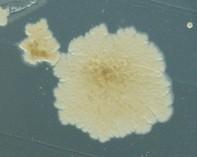 mycobacterium mycobacterium